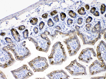 Cytokeratin 18/KRT18 Antibody