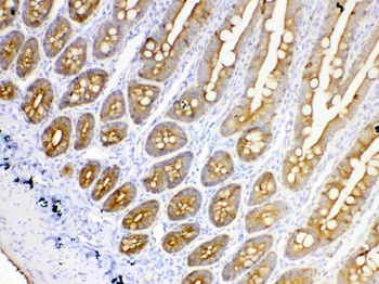 Cytokeratin 18/KRT18 Antibody