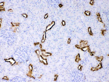Cytokeratin 18/KRT18 Antibody