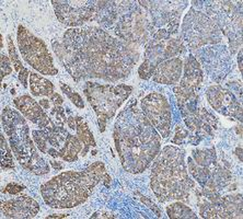 Cytokeratin 18/KRT18 Antibody