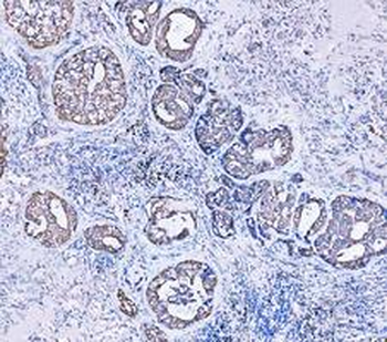 Cytokeratin 18/KRT18 Antibody