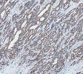 Cytokeratin 18/KRT18 Antibody