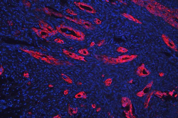 Cytokeratin 18/KRT18 Antibody