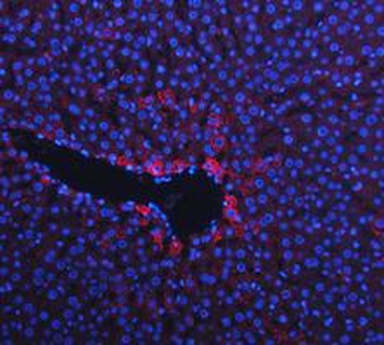 Cytokeratin 18/KRT18 Antibody