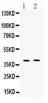 MC3 Receptor/MC3R Rabbit Polyclonal Antibody