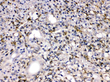 MMP11 Rabbit Polyclonal Antibody