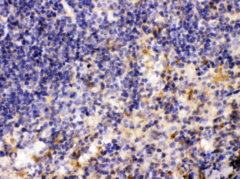 MMP11 Rabbit Polyclonal Antibody