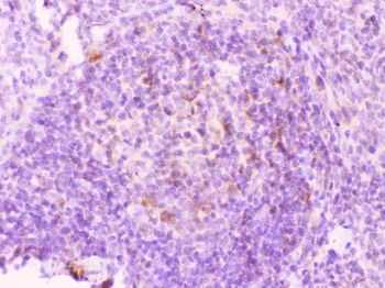 MMP11 Rabbit Polyclonal Antibody