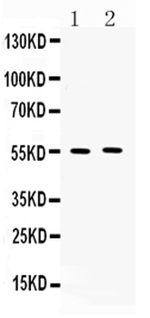 MMP11 Rabbit Polyclonal Antibody