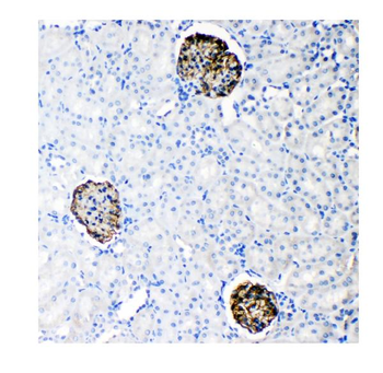 Nephrin/NPHS1 Rabbit Polyclonal Antibody