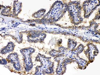 PDE5A Rabbit Polyclonal Antibody
