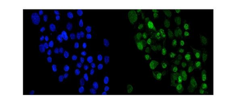 Periplakin/PPL Rabbit Polyclonal Antibody