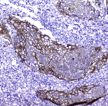 Periplakin/PPL Rabbit Polyclonal Antibody