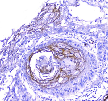 Periplakin/PPL Rabbit Polyclonal Antibody