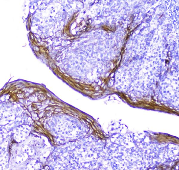 Periplakin/PPL Rabbit Polyclonal Antibody