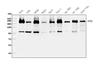 Periplakin/PPL Rabbit Polyclonal Antibody