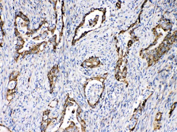 TECTA Rabbit Polyclonal Antibody