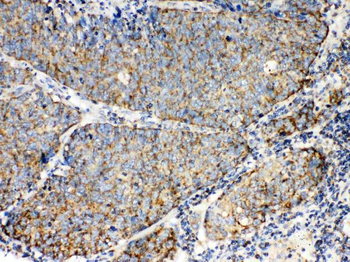 TECTA Rabbit Polyclonal Antibody