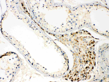 TECTA Rabbit Polyclonal Antibody