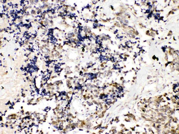 TRF2/TERF2 Rabbit Polyclonal Antibody