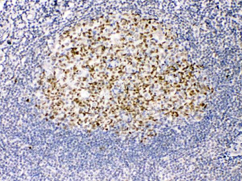 TRF2/TERF2 Rabbit Polyclonal Antibody