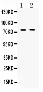 TRF2/TERF2 Rabbit Polyclonal Antibody