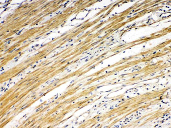 DR5/TNFRSF10B Antibody