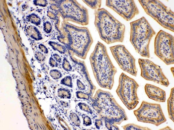 DR5/TNFRSF10B Antibody