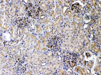 DR5/TNFRSF10B Antibody