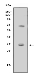 TREML1 Rabbit Polyclonal Antibody