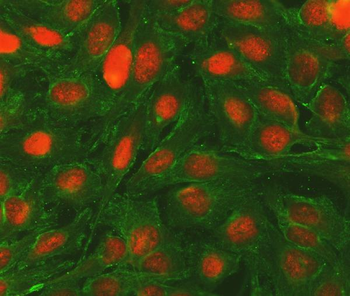 Bcl-2/BCL2 Antibody