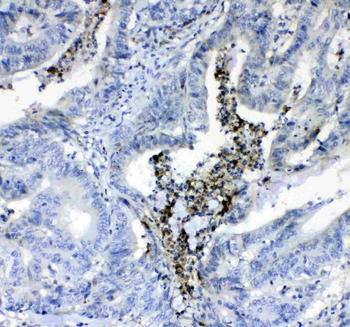 Prothrombin/F2 Rabbit Polyclonal Antibody