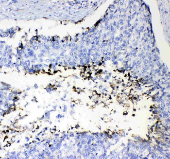 Prothrombin/F2 Rabbit Polyclonal Antibody