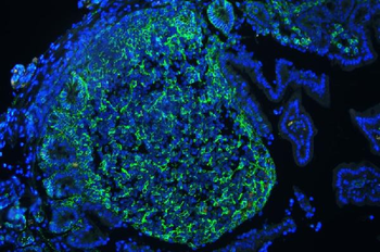 CD44 Antibody