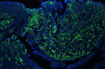 CD44 Antibody