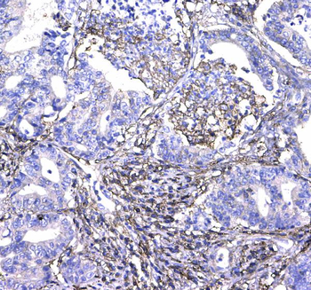 CD44 Antibody