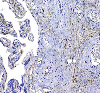 CD44 Antibody