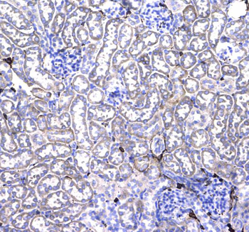 CD44 Antibody
