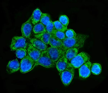HLA-DQB1/HLA Rabbit Polyclonal Antibody
