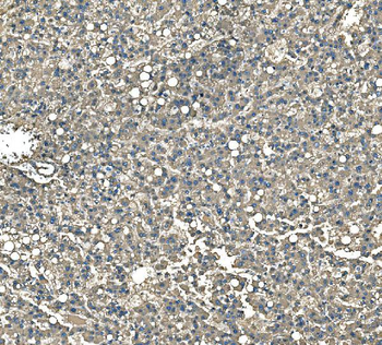 Serum Amyloid P/APCS Rabbit Polyclonal Antibody