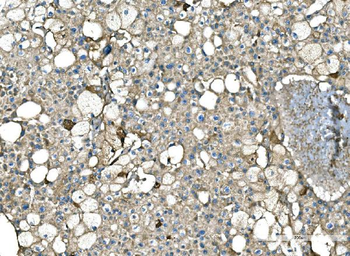 Serum Amyloid P/APCS Rabbit Polyclonal Antibody