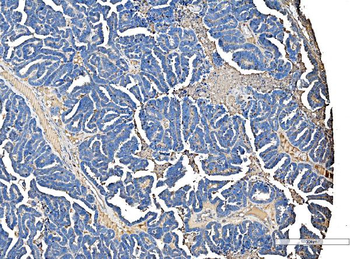 Serum Amyloid P/APCS Rabbit Polyclonal Antibody