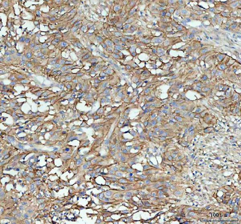 ICAM1 Antibody