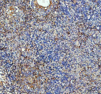 ICAM1 Antibody