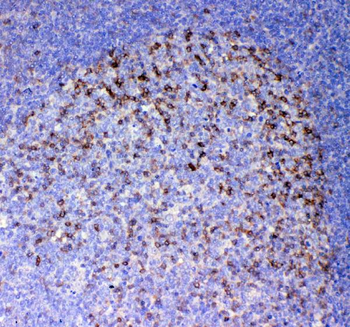 ICOS Rabbit Polyclonal Antibody