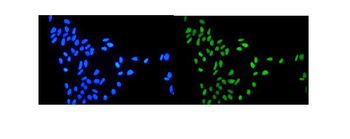 Topoisomerase I/TOP1 Rabbit Polyclonal Antibody