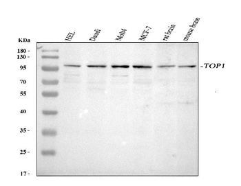 Topoisomerase I/TOP1 Rabbit Polyclonal Antibody