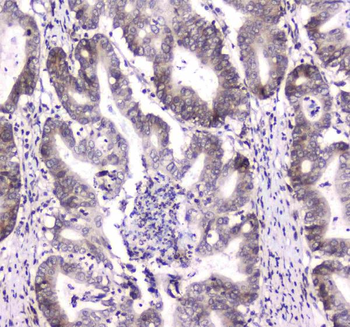 DGCR8 Rabbit Polyclonal Antibody