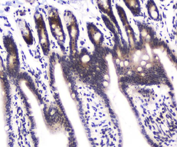 DGCR8 Rabbit Polyclonal Antibody
