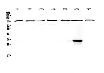 DGCR8 Rabbit Polyclonal Antibody